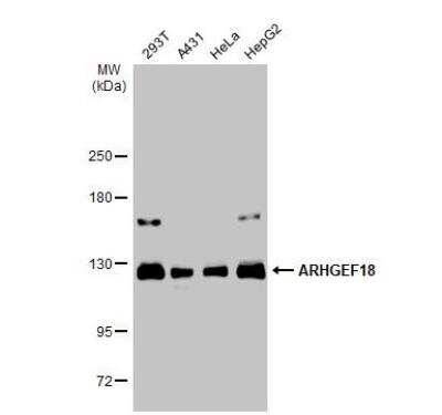 Western Blot: p114RhoGEF Antibody [NBP1-32816]