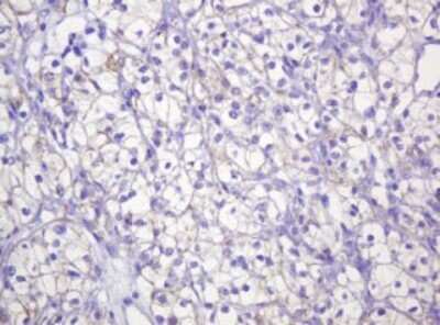 Immunohistochemistry: p120-catenin Antibody (OTI2E8) [NBP2-45646]