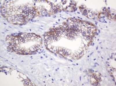 Immunohistochemistry: p120-catenin Antibody (OTI2E8) [NBP2-45646]