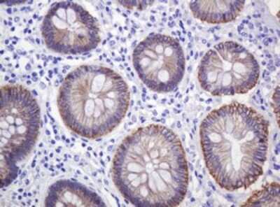 Immunohistochemistry: p120-catenin Antibody (OTI2E8) [NBP2-45646]