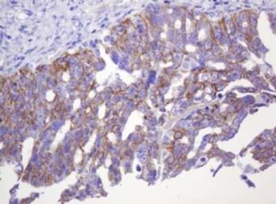 Immunohistochemistry: p120-catenin Antibody (OTI2E8) [NBP2-45646]
