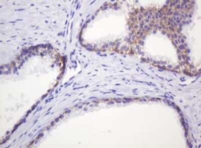 Immunohistochemistry: p120-catenin Antibody (OTI2E8) [NBP2-45646]