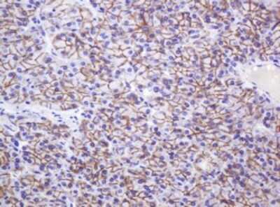 Immunohistochemistry: p120-catenin Antibody (OTI2E8) [NBP2-45646]