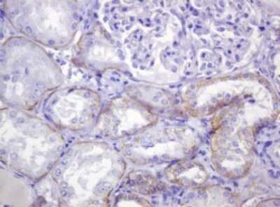 Immunohistochemistry: p120-catenin Antibody (OTI2E8) [NBP2-45646]