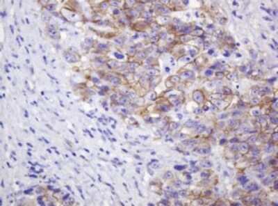 Immunohistochemistry: p120-catenin Antibody (OTI2E8) [NBP2-45646]