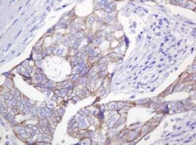 Immunohistochemistry: p120-catenin Antibody (OTI2E8) [NBP2-45646]