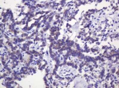 Immunohistochemistry: p120-catenin Antibody (OTI2E8) [NBP2-45646]