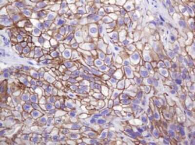 Immunohistochemistry: p120-catenin Antibody (OTI2E8) [NBP2-45646]