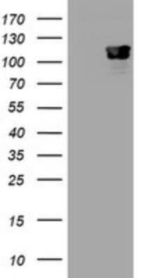 Western Blot: p120-catenin Antibody (OTI2E8) [NBP2-45646]