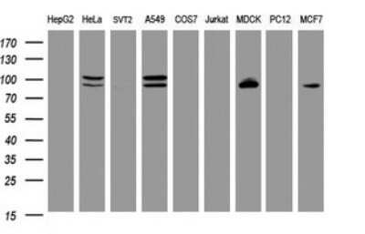 Western Blot: p120-catenin Antibody (OTI2E8) [NBP2-45646]