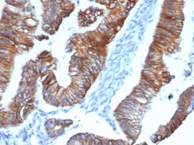 Immunohistochemistry-Paraffin: p120-catenin Antibody (CTNND1/4383R) - Azide and BSA Free [NBP3-08618]