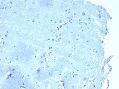 Immunohistochemistry-Paraffin: p120-catenin Antibody (CTNND1/4383R) - Azide and BSA Free [NBP3-08618]