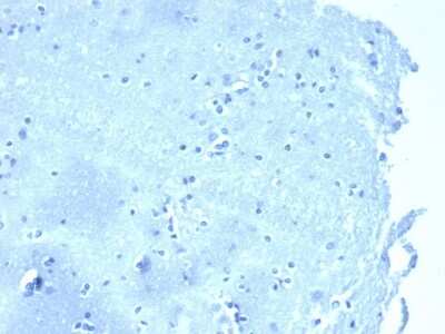 Immunohistochemistry-Paraffin: p120-catenin Antibody (CTNND1/4383R) [NBP3-07802]