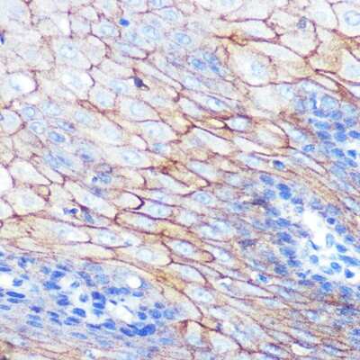 Immunohistochemistry-Paraffin: p120-catenin Antibody (5N7Z0) [NBP3-15375]