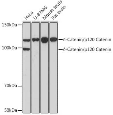 Western Blot: p120-catenin Antibody (5N7Z0) [NBP3-15375]