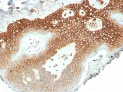 Immunohistochemistry-Paraffin: p120-catenin Antibody (CTNND1/4501) - Azide and BSA Free [NBP3-08614]