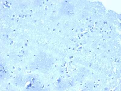 Immunohistochemistry-Paraffin: p120-catenin Antibody (CTNND1/4501) - Azide and BSA Free [NBP3-08614]