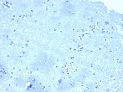 Immunohistochemistry-Paraffin: p120-catenin Antibody (CTNND1/4501) [NBP3-07801]