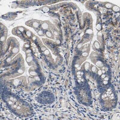 Immunohistochemistry-Paraffin: p120-catenin Antibody [NBP1-85383]