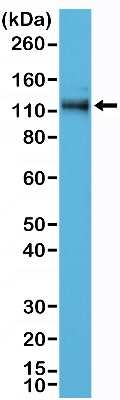 Western Blot: p120-catenin Antibody (RM353) [NBP2-77423]