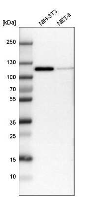 Western Blot: p120-catenin Antibody [NBP1-85383]