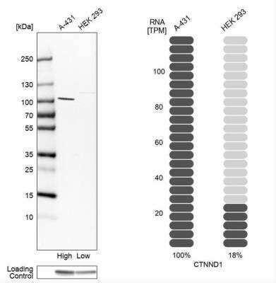 Western Blot: p120-catenin Antibody [NBP1-85383]