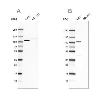 Western Blot: p120-catenin Antibody [NBP1-85383]