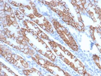 Immunohistochemistry-Paraffin: p120-catenin Antibody (rCTNND1/6903) [NBP3-13859]