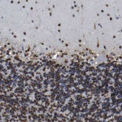 Immunohistochemistry-Paraffin: p130 Antibody [NBP1-82455]