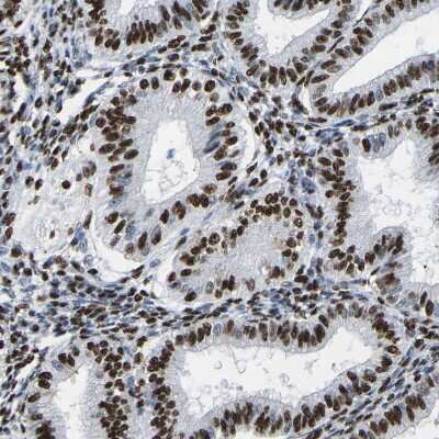Immunohistochemistry-Paraffin: p130 Antibody [NBP1-82455]