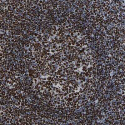 Immunohistochemistry-Paraffin: p130 Antibody [NBP1-82455]