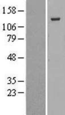 Western Blot: p130 Overexpression Lysate [NBL1-15193]