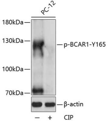 Western Blot: p130Cas/BCAR1 [p Tyr165] AntibodyAzide and BSA Free [NBP3-05456]