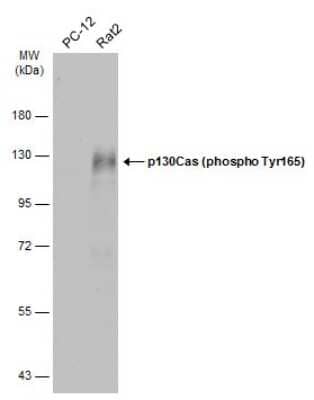 Western Blot: p130Cas/BCAR1 [p Tyr165] Antibody [NBP3-13075]