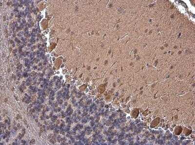 Immunohistochemistry-Paraffin: p130Cas/BCAR1 Antibody (GT331) [NBP3-13565]