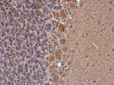 Immunohistochemistry-Paraffin: p130Cas/BCAR1 Antibody (GT331) [NBP3-13565]