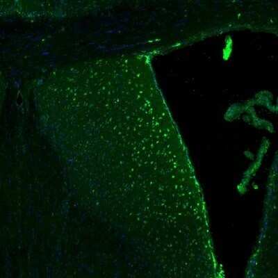 Immunohistochemistry: p130Cas/BCAR1 Antibody [NBP2-34076]