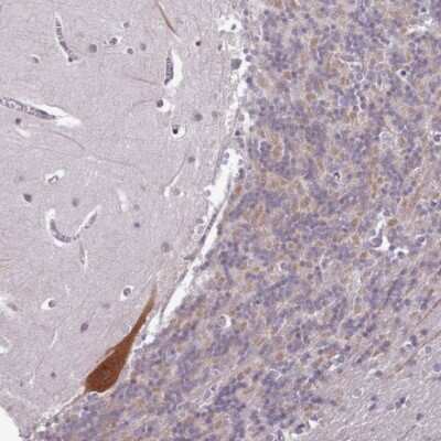 Immunohistochemistry-Paraffin: p130Cas/BCAR1 Antibody [NBP2-34076]