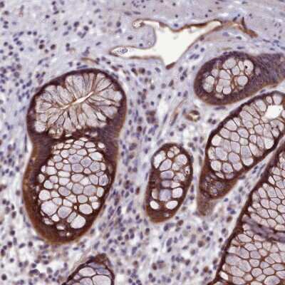Immunohistochemistry-Paraffin: p130Cas/BCAR1 Antibody [NBP2-34076]