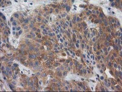 Immunohistochemistry: p130Cas/BCAR1 Antibody (OTI1A9) - Azide and BSA Free [NBP2-73181]