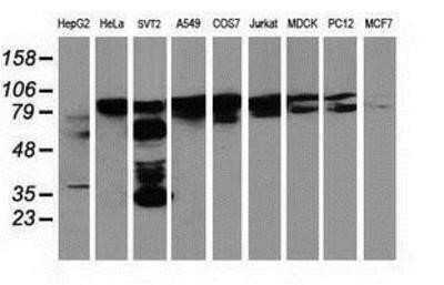 Western Blot: p130Cas/BCAR1 Antibody (OTI1A9)Azide and BSA Free [NBP2-73181]