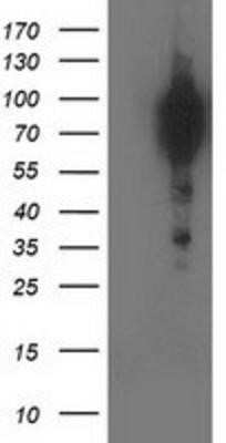 Western Blot: p130Cas/BCAR1 Antibody (OTI1A9)Azide and BSA Free [NBP2-73181]