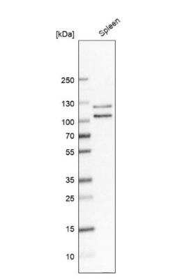 Western Blot: p130Cas/BCAR1 Antibody [NBP2-34076]