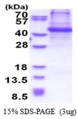 SDS-PAGE: Recombinant Human p130Cas/BCAR1 His Protein [NBP2-51554]
