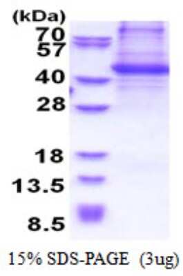 SDS-PAGE: Recombinant Human p130Cas/BCAR1 His Protein [NBP2-51554]