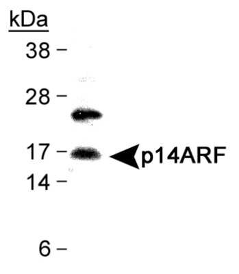 Western Blot: p14ARF/CDKN2A Antibody [NB110-59085]