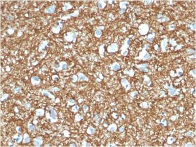 Immunohistochemistry-Paraffin: p14ARF/CDKN2A Antibody (4C6/4) [NBP3-07234]