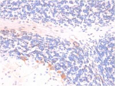 Immunohistochemistry-Paraffin: p14ARF/CDKN2A Antibody (4C6/4) [NBP3-07234]