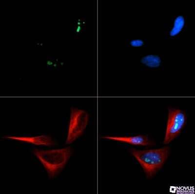 Immunocytochemistry/ Immunofluorescence: p14ARF/CDKN2A Antibody - BSA Free [NB200-111]
