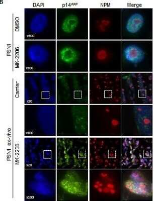 Immunohistochemistry: p14ARF/CDKN2A Antibody - BSA Free [NB200-111]